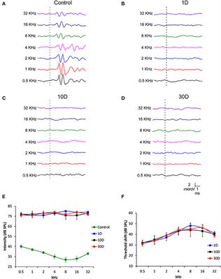 The Role of Glia in the Peripheral and Central Auditory System Following Noise Overexposure: Contribution of TNF-α and IL-1β to the Pathogenesis of Hearing Loss